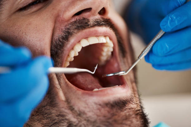 Best Knocked-Out Tooth Emergency  in South Hill, VA