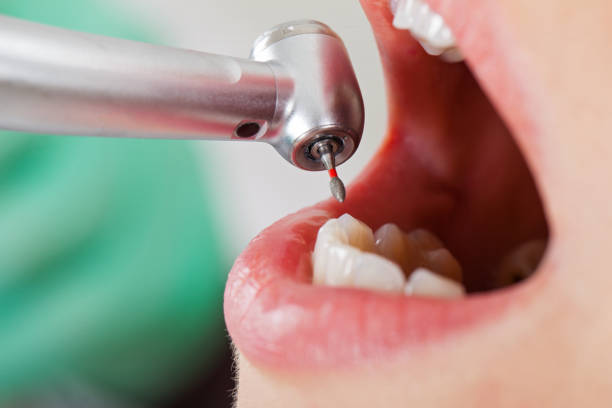 Best Emergency Gum Pain Relief  in South Hill, VA